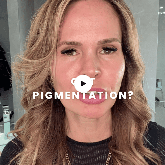 Do you have pigmentation?