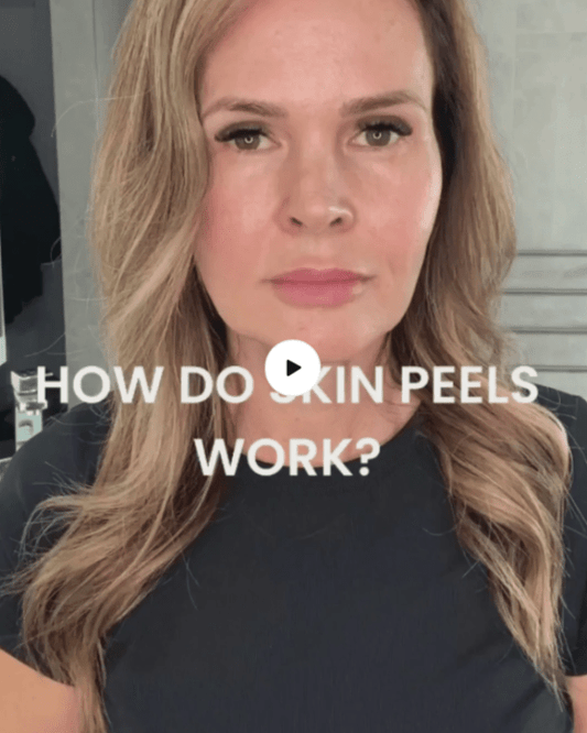 How do skin peels work?